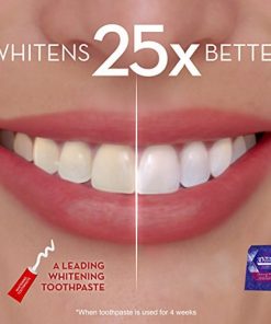 Glamorous White whitening strips